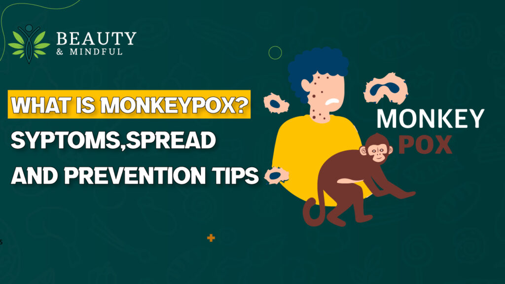 What is Monkeypox